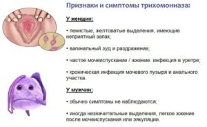 Можно ли заразиться молочницей от слюны мужчины