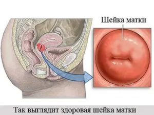 Шейка матки можно ли пальцами нащупать рак