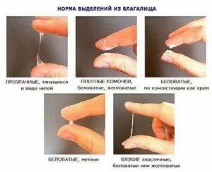 Могут ли быть тянущие боли внизу живота при молочнице