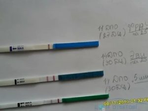 Что такое когда тянет живот и поясница болит а месячных нет