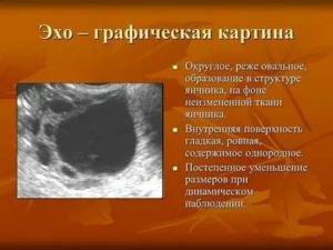 Что значит аваскулярная киста яичника