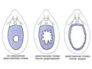 Когда девственности лишаешься может ли быть сбой в месячных