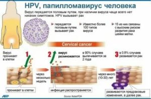 Чем лечить впч у женщин гинекология препараты