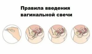 Когда можно идти в туалет после вагинальных таблеток