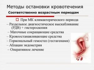 Маточные кровотечения в предклимактерическом периоде