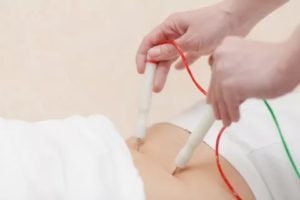 Компьютерная рефлексотерапия при эндометриозе отзывы