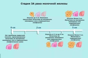 Растворимый кофе рак молочной железы