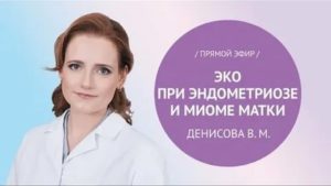 Эко при эндометриозе у кого получилось отзывы