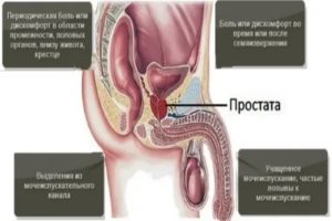 Боли в простате в сидячем положении