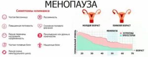 Продолжительность климакса у женщин после 50 лет