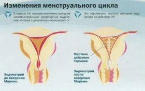 Могут ли противозачаточные свечи влиять на месячные