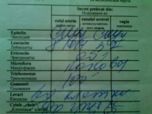 Молочница как определить по анализу мазка