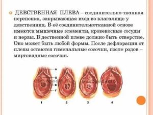 Девственная плева можно ли увидеть на узи