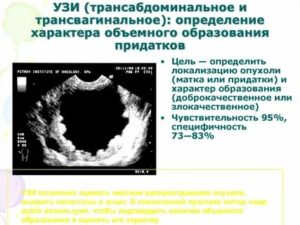 Узи матки и придатков твузи трузи трансабдоминальное цдк что это