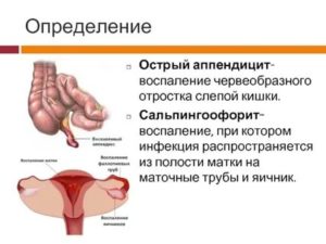 Как определить аппендицит или киста яичника