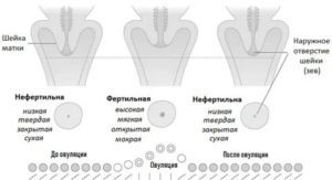 Какая должна быть матка перед месячными мягкая или твердая