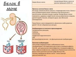 Может ли повышаться белок в моче перед месячными