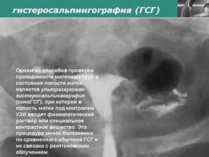 Соногистеросальпингоскопия проходимость маточных труб под контролем узи