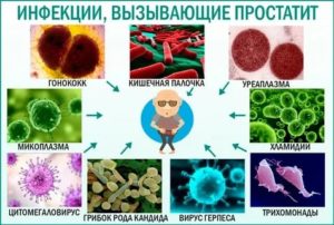 Бактериальный простатит вызванный кишечной палочкой