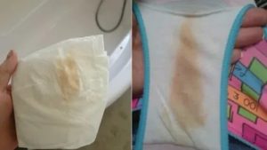 Что означают розоватые выделения за несколько дней до месячных