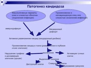 Этиология и патогенез кандидоза полости рта