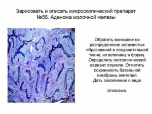 Препараты при аденоме молочной железы