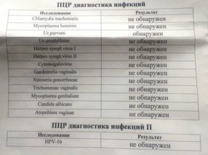 Когда лучше сдавать анализы на скрытые инфекции до или после месячных