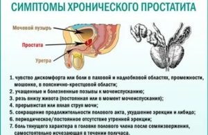 Что такое эстрогенотерапия предстательной железы