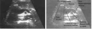 Если газы в кишечнике узи яичников