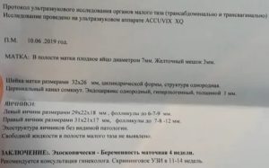 Что может показать узи малого таза у женщин при климаксе