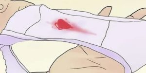 Что делать если нет прокладок а месячные начались сильные