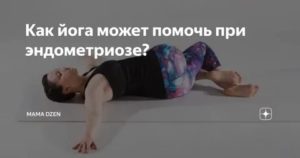 Йога при эндометриозе отзывы