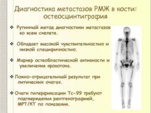 Метастазы в кости при раке молочной железы диагностика