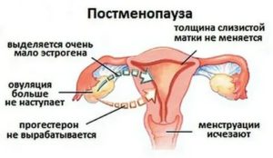 Что происходит с яичниками при климаксе