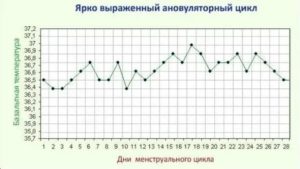 Ановуляторные циклы при эндометриозе