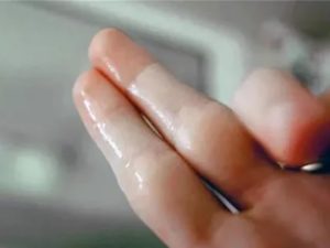 Жидкие как вода выделения при молочнице