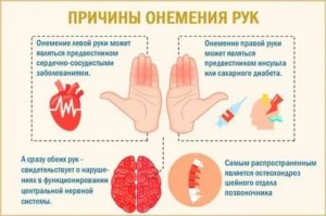 Онемение пальцев рук ночью причины и лечение при климаксе