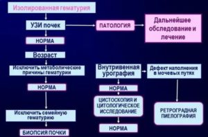 Лечение антибиотиками при гематурии у мужчин