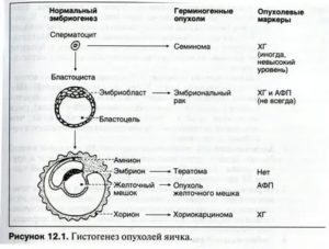 Маркеры опухолей яичек