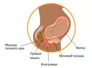 Может ли матка давить на мочевой пузырь при месячных