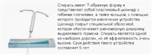 Спираль мирена при эндометриозе отзывы врачей специалистов при эндометриозе