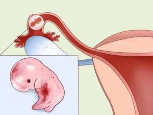 Могут ли месячные пропустить один месяц