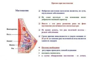 Можно ли делать подтяжку груди при фиброзно-кистозной мастопатии