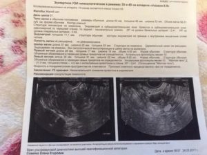 Шейка матки узи что означает структура однородная