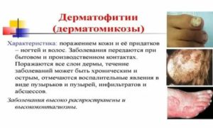 Кандидозы и дерматофитии это