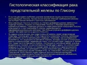 Что такое местнораспространенный рак предстательной железы