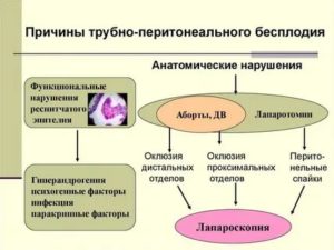 Женское бесплодие трубного происхождения что это такое