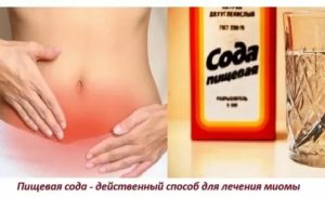 Лечение содой при миоме матки неумывакин