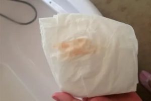 Что может быть если идет вместо месячных кровотечение