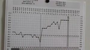 Может ли при эндометриозе подниматься температура